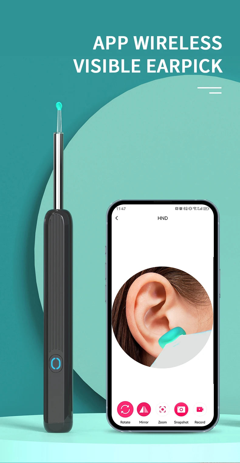SmartScope™ HD Earwax Remover – Wireless Visual Ear Camera Cleaner