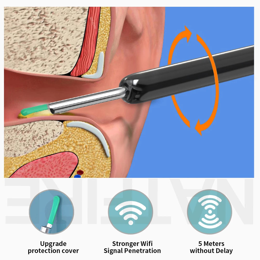 SmartScope™ HD Earwax Remover – Wireless Visual Ear Camera Cleaner