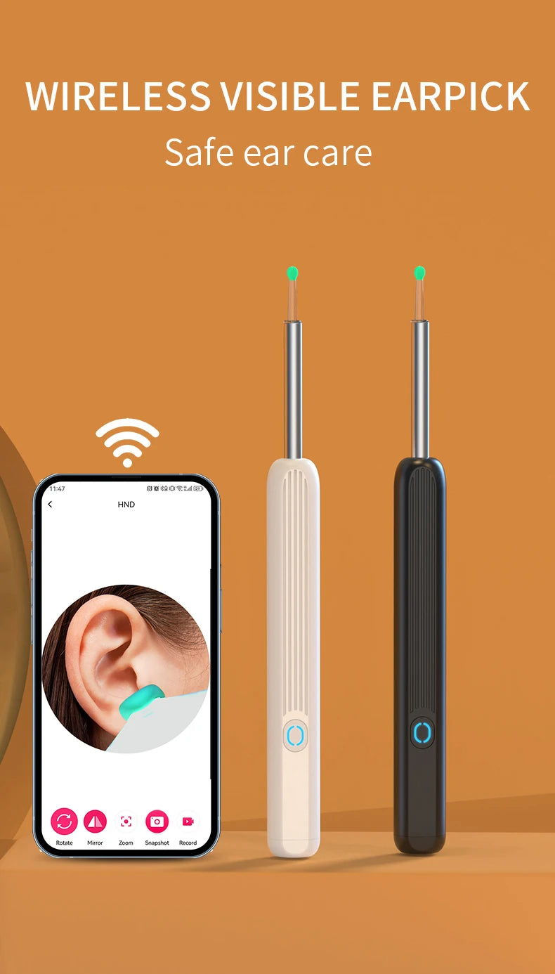 SmartScope™ HD Earwax Remover – Wireless Visual Ear Camera Cleaner