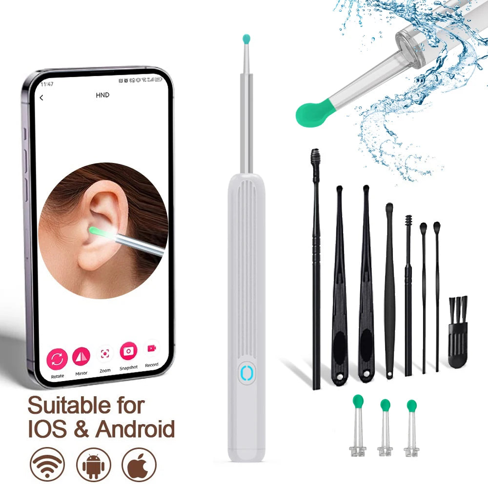 SmartScope™ HD Earwax Remover – Wireless Visual Ear Camera Cleaner