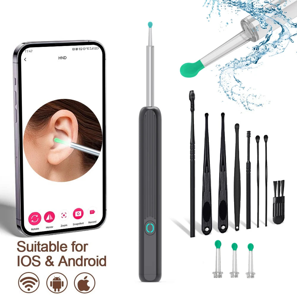SmartScope™ HD Earwax Remover – Wireless Visual Ear Camera Cleaner